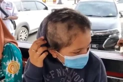 2 Wanita Cantik di Medan Disekap dan Digunduli Rambutnya Gara-gara Tuduhan Selingkuh