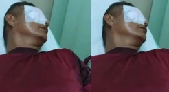 Astaga! Guru di Rejang Lebong Alami Kebutaan usai Dikatapel Orang Tua Murid