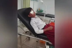 Penusuk Mata Siswi SD di Buton Selatan Diskorsing 1 Bulan