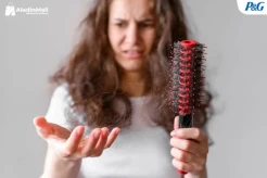 7 Cara Mengatasi Rambut Rontok, Paling Utama Terapkan Pola Hidup Sehat