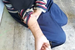 Miris, Puluhan Siswi SMPN 2 Saptosari Ramai-ramai Sayat Pergelangan Tangan