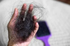 Rambut Rontok Berlebih Bisa Jadi Tanda Anemia, Ini Cara Mengobatinya