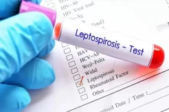 Wabah Leptospirosis Melanda Grobogan, 2 Warga Meninggal Dunia
