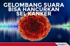 Riset Terbaru Sebut Gelombang Suara Bisa Hancurkan Sel Kanker