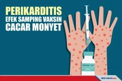 Kenali Perikarditis, Efek Samping Penggunaan Vaksin Cacar Monyet