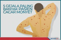 Ini 5 Gejala Cacar Monyet yang Paling Sering Dialami Pasien