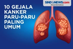 10 Gejala Kanker Paru-Paru yang Paling Umum Terjadi