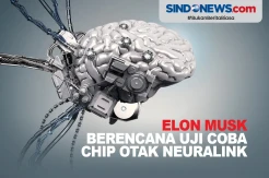 Chip Otak Nirkabel Neuralink Akan Diuji Coba pada Manusia