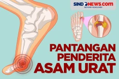 Picu Nyeri Hebat, Berikut Makanan Pantangan Penderita Asam Urat