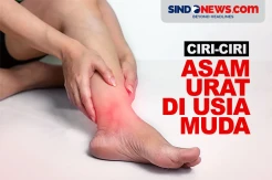 Ciri-ciri Asam Urat di Usia Muda, Jangan Dianggap Sepele!