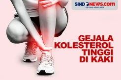 5 Gejala Kolesterol Tinggi di Kaki, Biasanya Hilang usai Istirahat