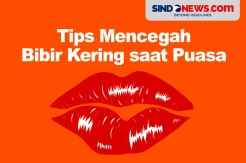 Tips Mengatasi Bibir Kering dan Pecah saat Puasa Ramadan