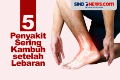 Waspada! 5 Penyakit Ini Sering Kambuh setelah Lebaran