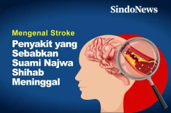 Mengenal Stroke, Penyebab Suami Najwa Shihab Meninggal