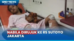 Tuai Simpati, Bocah yang Diamputasi karena Selamatkan Kucing Dirujuk ke Jakarta