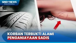 Selesai Autopsi, Wanita Korban Penganiayaan oleh Anak Anggota DPR Alami Penganiayaan Sadis