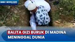 Balita Pengidap Gizi Buruk Meninggal Dunia di Madina, Tak Ada Biaya Berobat