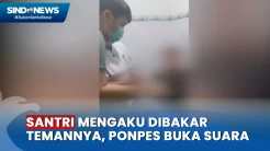 Viral! Santri di Palembang Ngaku Dibakar Temannya, Ini Tanggapan Pihak Ponpes