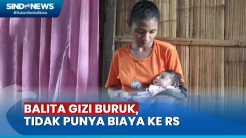 Setiap Hari Makan Ubi dan Pisang, Balita Idap Gizi Buruk di Sikka