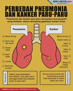 Simak! Ini Perbedaan...