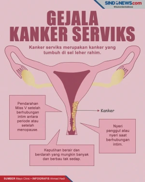 Perempuan Wajib Tahu,...