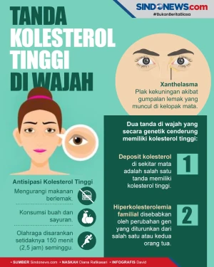 Tanda Kolesterol di...