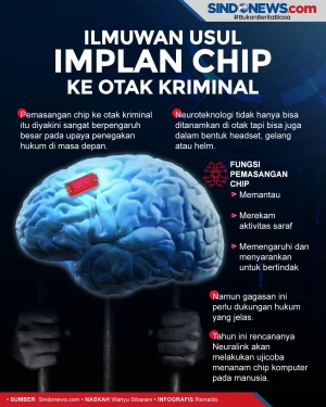 Ilmuwan Usulkan Implan...