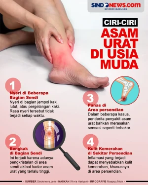Ciri-ciri Asam Urat...