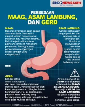 Serupa tapi Tak Sama,...