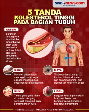 5 Tanda Bahaya Kolesterol...