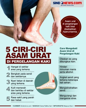 5 Ciri Asam Urat di...