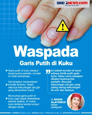 Waspada Garis Putih...