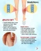 Chronic Venous Insufficiency,...