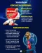 Final Liga Champions...