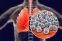 floating-Waspada Kasus Pneumonia...
