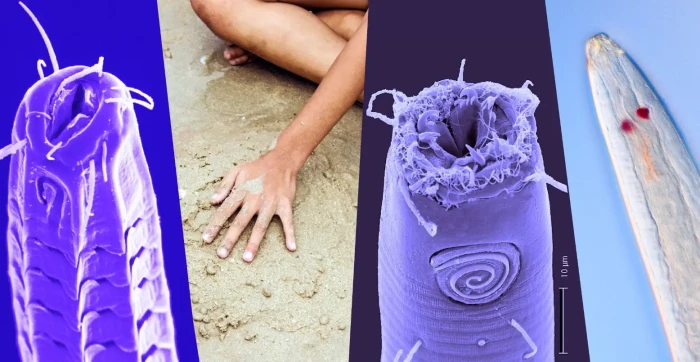 Mengenal Nematoda, Cacing...