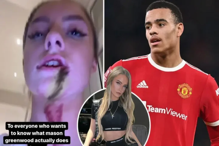 Sadis! Mason Greenwood...