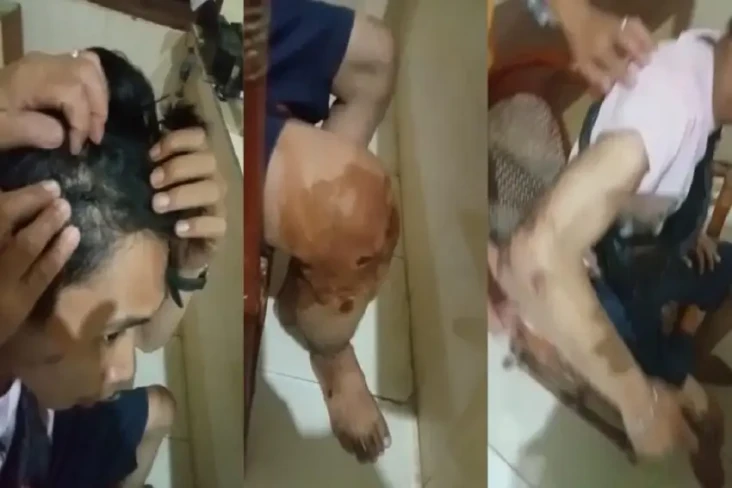 Seorang Ojol Luka Parah...