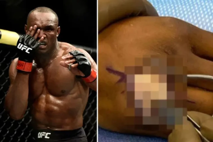 Tangan Kamaru Usman...