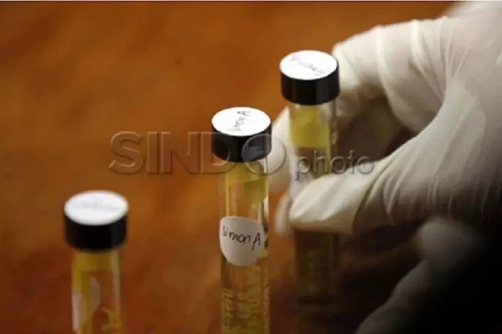Hasil Tes Urine Penabrak...
