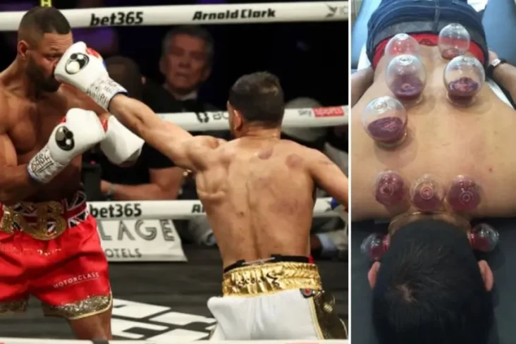 Amir Khan Kalah TKO...