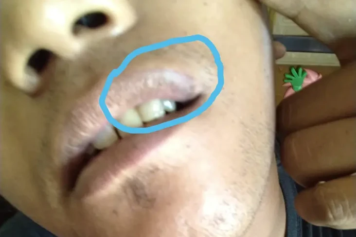 Mantan Polisi Aniaya...
