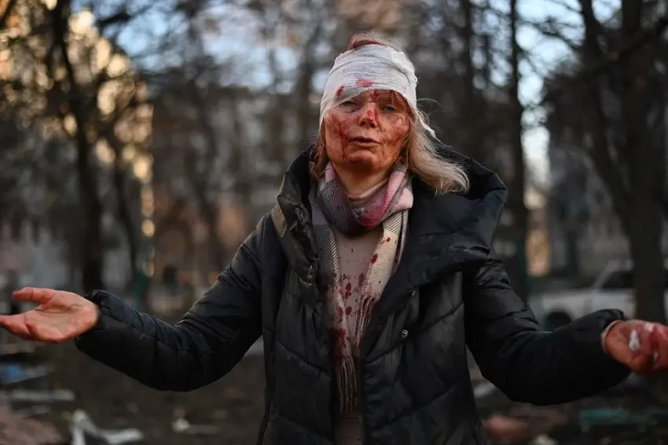 Wanita Ukraina Berlumuran...