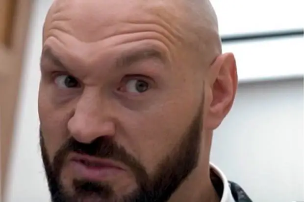 Tyson Fury Kecam Mantan...