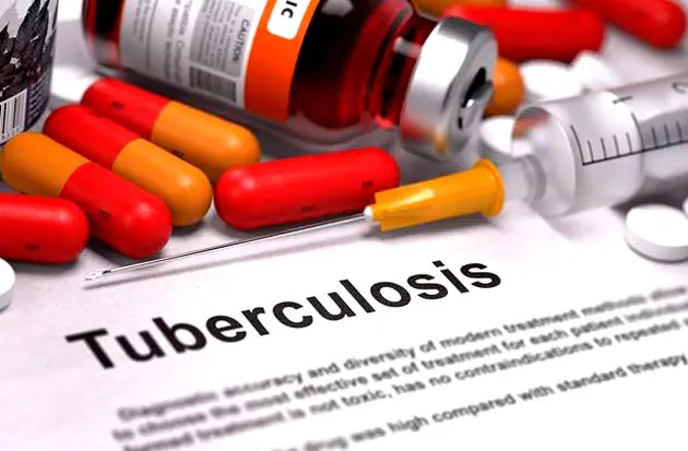 Penularan Penyakit Tuberkulosis...