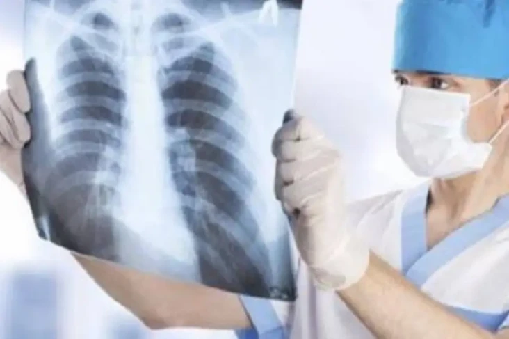Atasi Penyakit Tuberkulosis,...