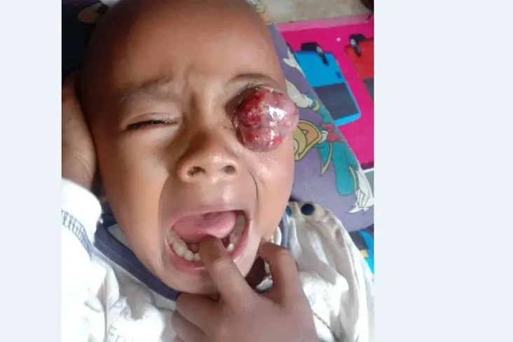 Miris, Berharap Bantuan...