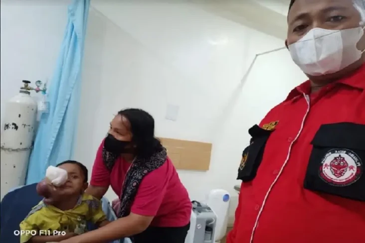 Bocah Penderita Tumor...