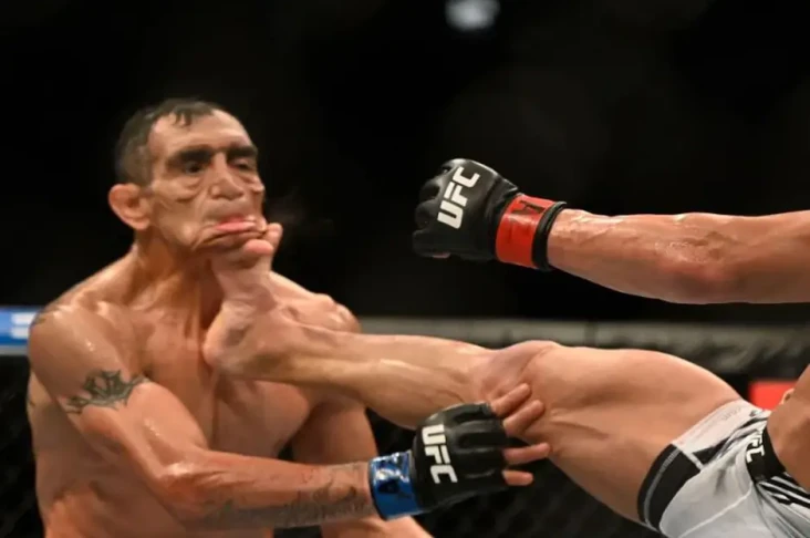 Wajah Petarung UFC Rusak...