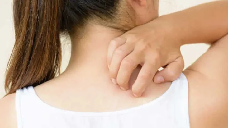 Cara Mengobati Ringworm...